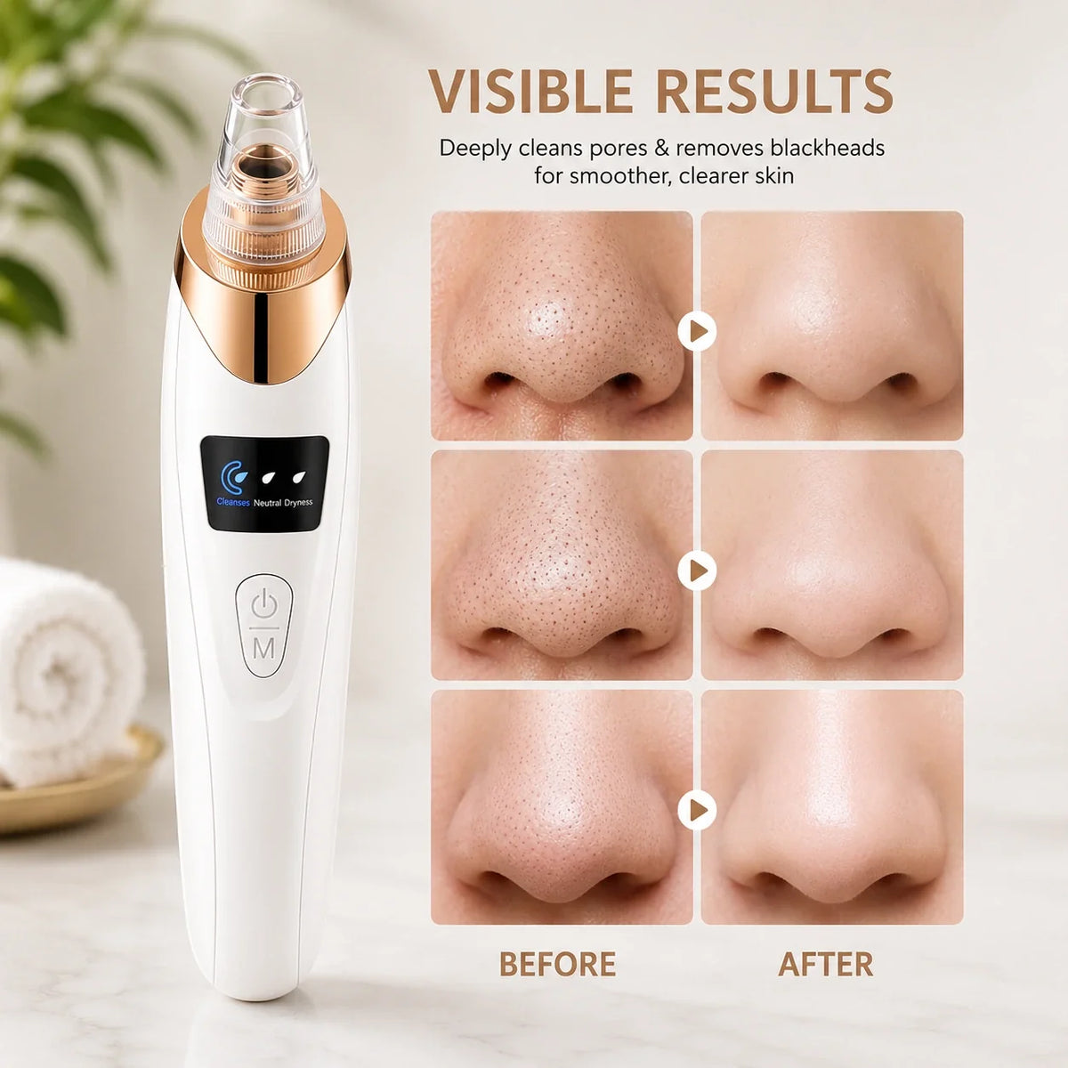 GlowVeya electric blackhead remover vacuum before and after pore cleansing results