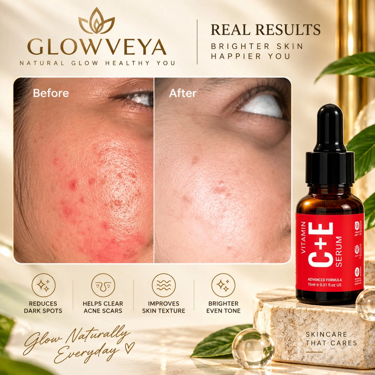 GlowVeya Vitamin C and E Serum before and after results for dark spots and acne scars